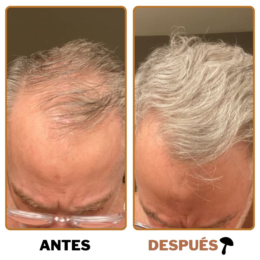 BioHair Pro™ | Reactiva Tu Crecimiento Del Cabello