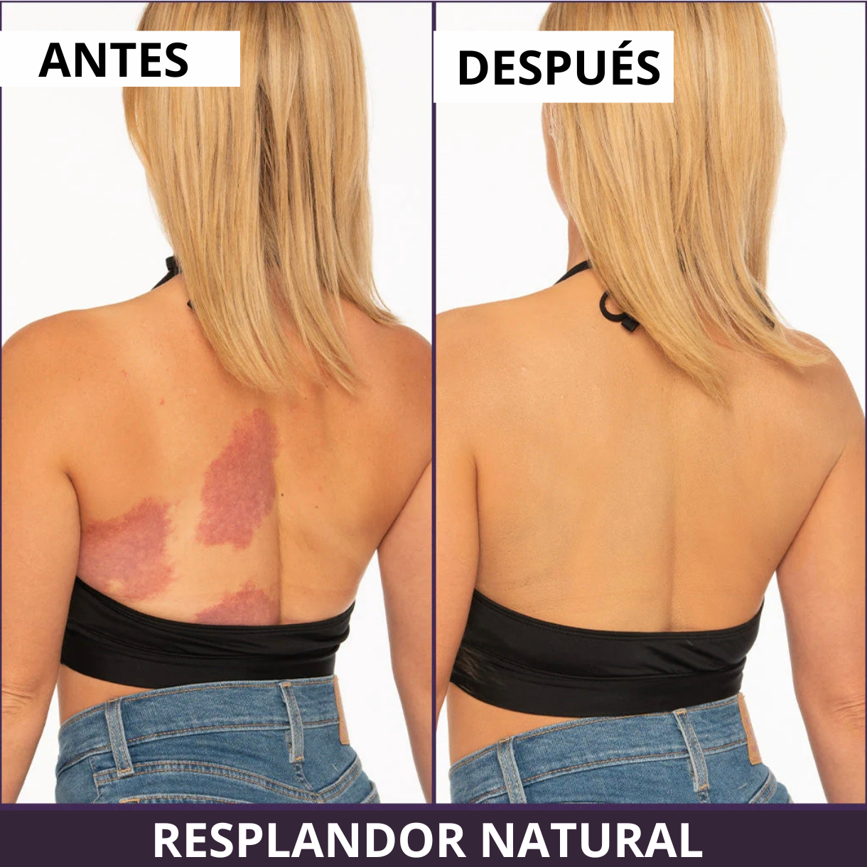 VELVÉRA™ | Clinical Body Finish