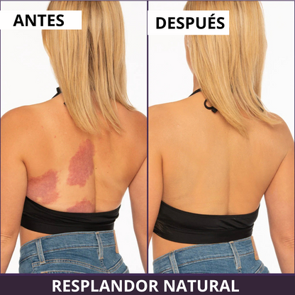 VELVÉRA™ | Clinical Body Finish