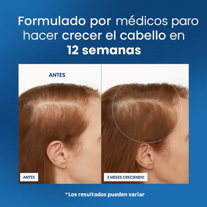 🚀 BODYWISE | BABY HAIRS EN 2 SEMANAS (2X1)