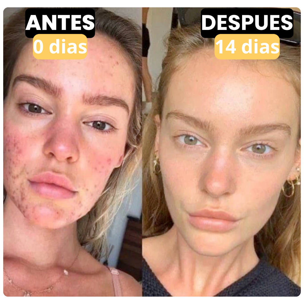 PRIMAL NOURISH™ | Crema De Sebo De Res Orgánico y Miel De Manuka