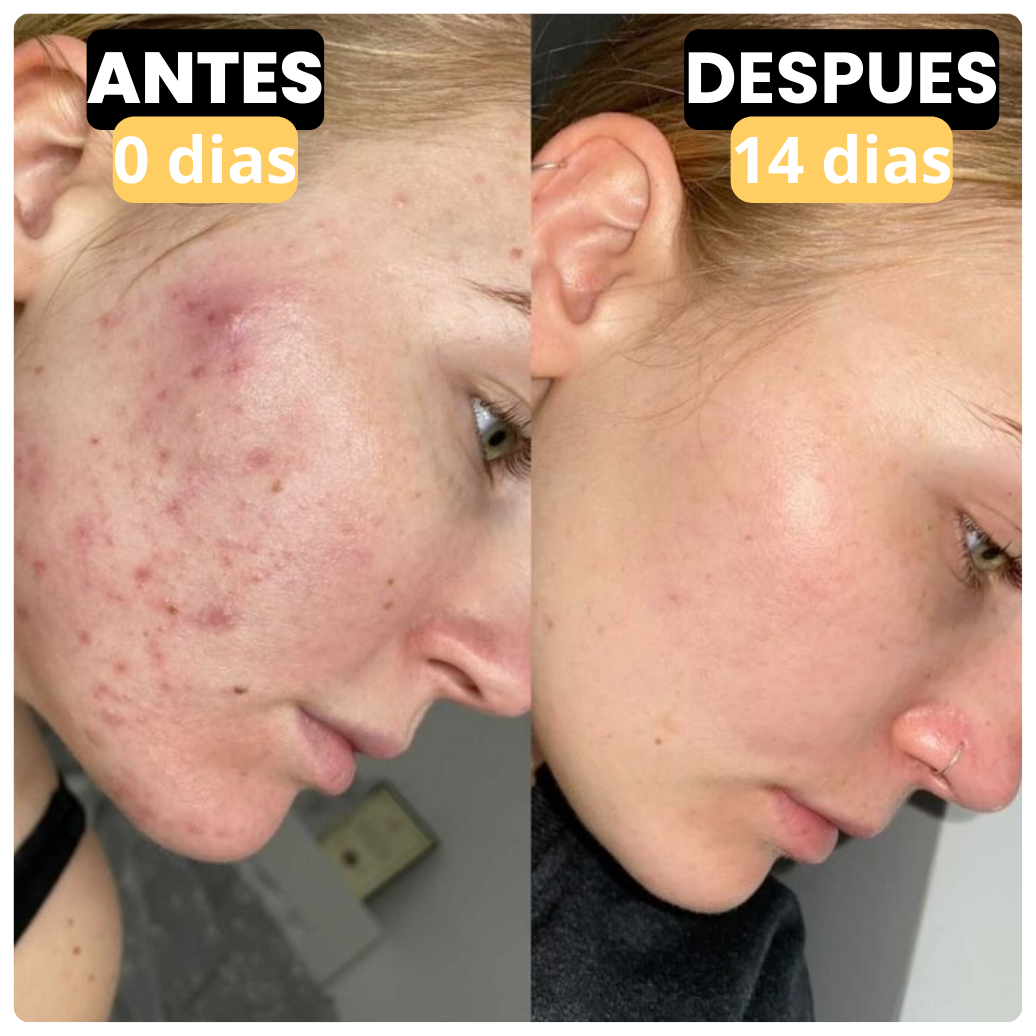 PRIMAL NOURISH™ | Crema De Sebo De Res Orgánico y Miel De Manuka