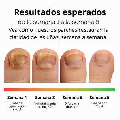 🌿 DERMAPURE | TRATAMIENTO ANTIFÚNGICO PROFESIONAL