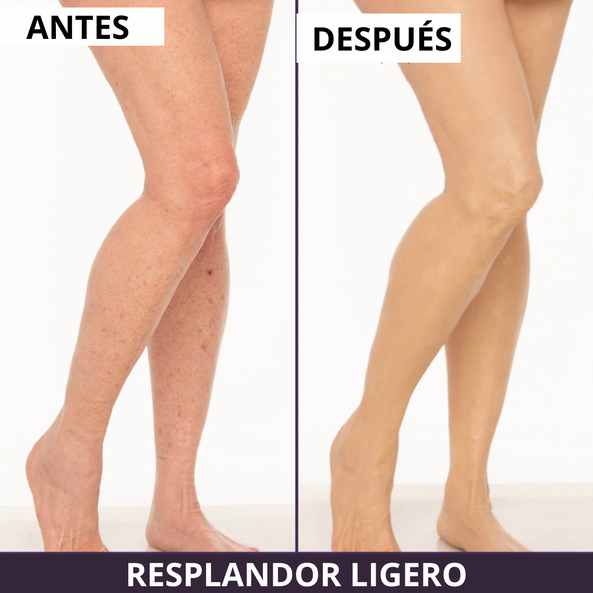 VELVÉRA™ | Clinical Body Finish