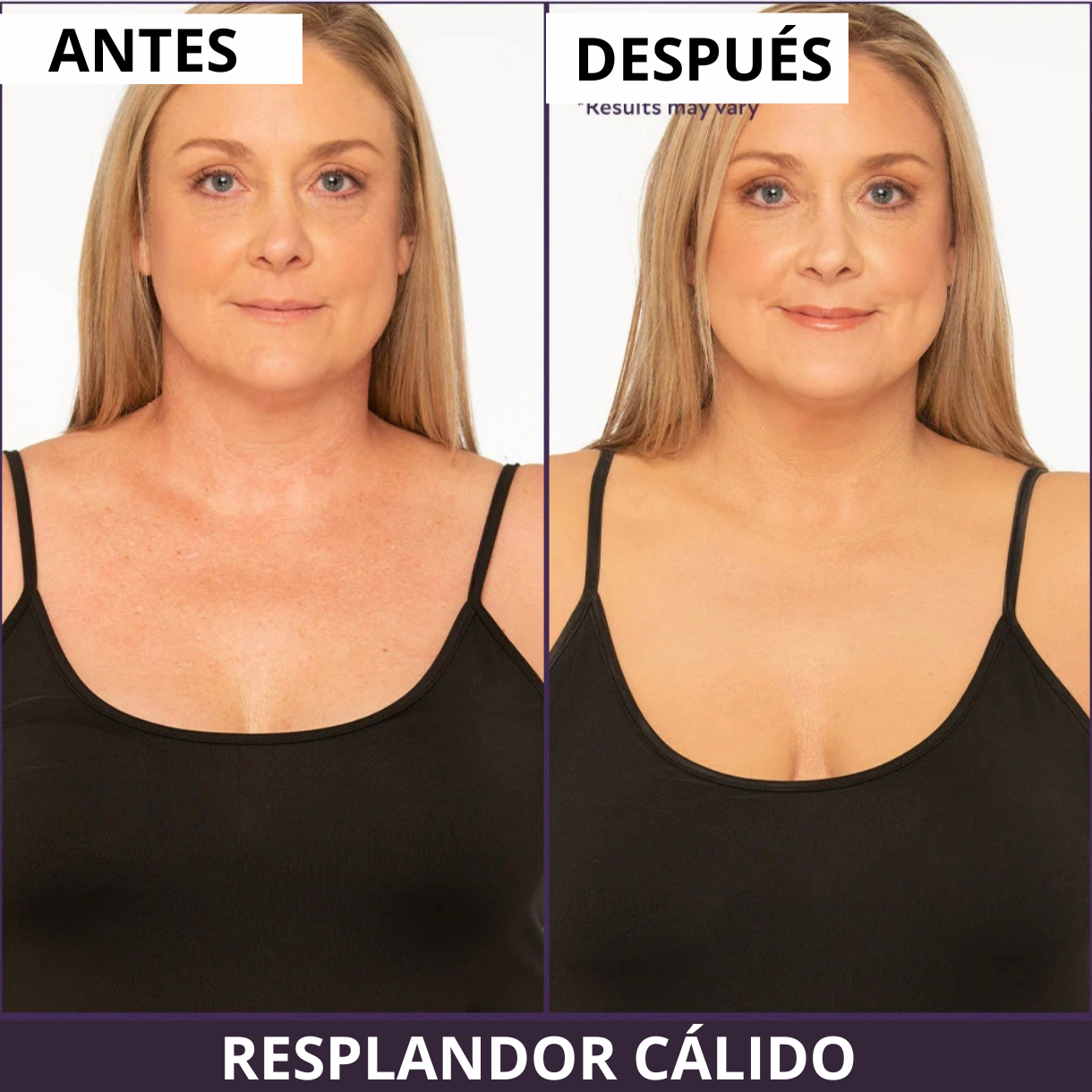 VELVÉRA™ | Clinical Body Finish