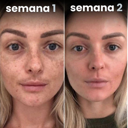 GUMMIFIT® | REDUCE 15 KILOS EN 2 SEMANAS