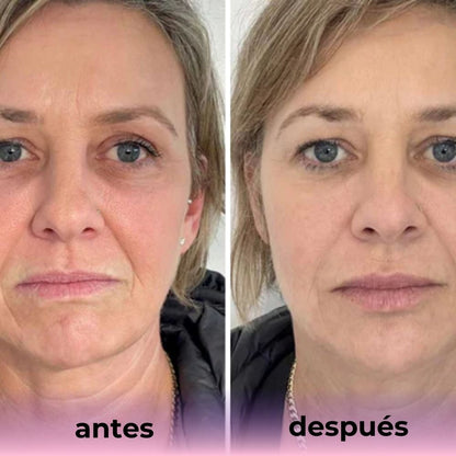 Mascarilla de Bio-Colágeno (PACK DE 2 + 2 EXTRA GRATIS)