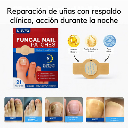 🌿 DERMAPURE | TRATAMIENTO ANTIFÚNGICO PROFESIONAL