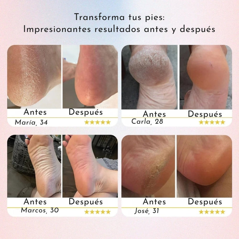 PediGlow™ | Belleza Real Empieza por los Pies