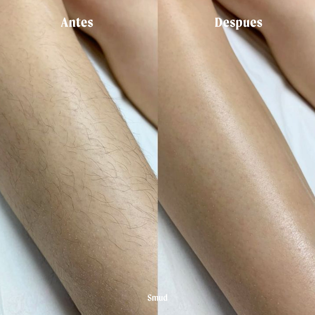 VeluxSkin™ | Depilación Inteligente, Piel Suave Sin Esfuerzo.
