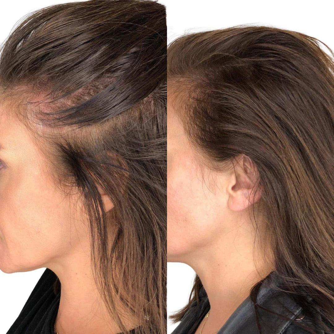 HairBloom™ | Donde Tu Cabello Vuelve a Florecer 🌸