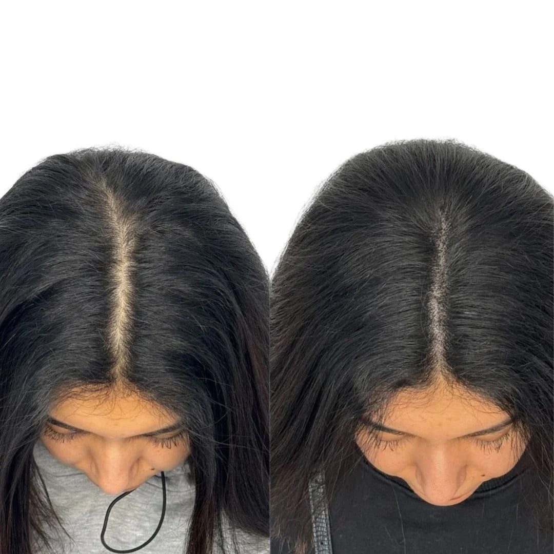 HairBloom™ | Donde Tu Cabello Vuelve a Florecer 🌸