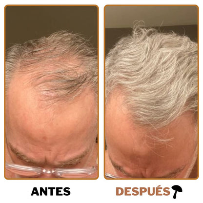 BioHair Pro™ | Reactiva Tu Crecimiento Del Cabello