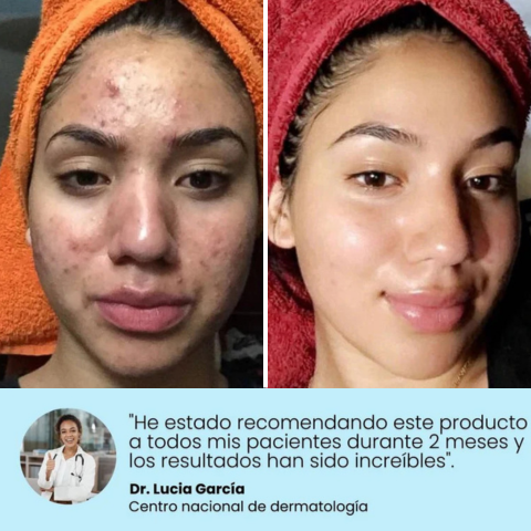 GUMMIFIT® | REDUCE 15 KILOS EN 2 SEMANAS