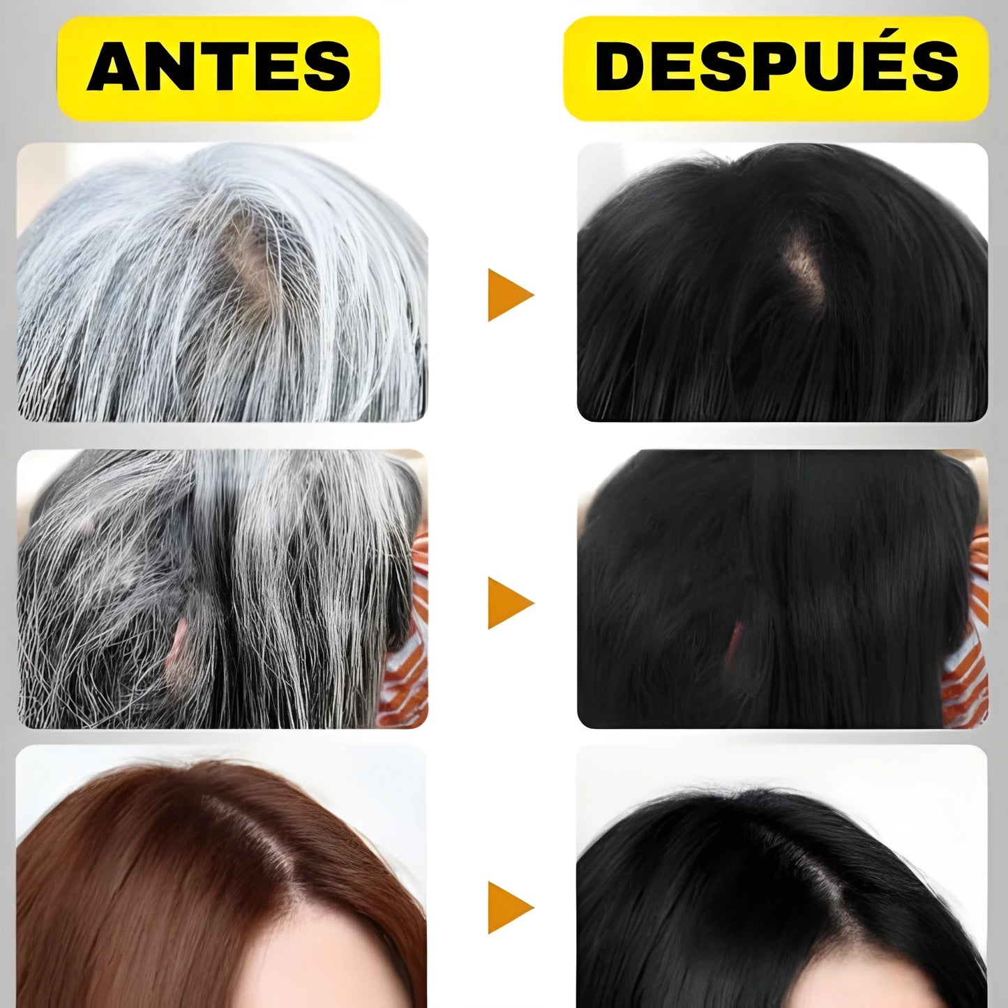 Shampoo Anticanas