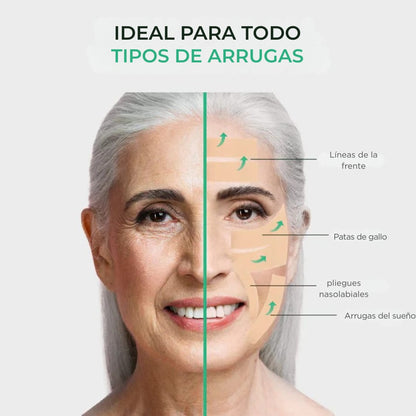 Cicatrix Vanish™ | Elimina Marcas De Acné, Cirugías y Quemaduras En 4 Semanas…!