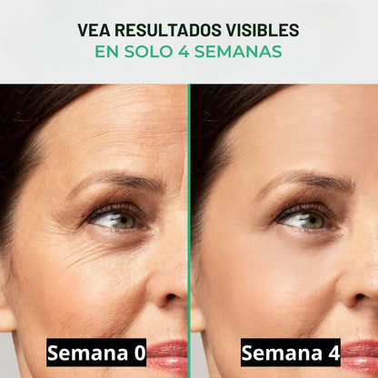 Cicatrix Vanish™ | Elimina Marcas De Acné, Cirugías y Quemaduras En 4 Semanas…!