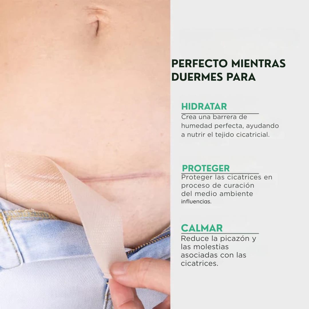 Cicatrix Vanish™ | Elimina Marcas De Acné, Cirugías y Quemaduras En 4 Semanas…!