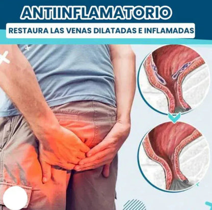 DICTAMNI (Alivio Rápido de Hemorroides y Fisuras)